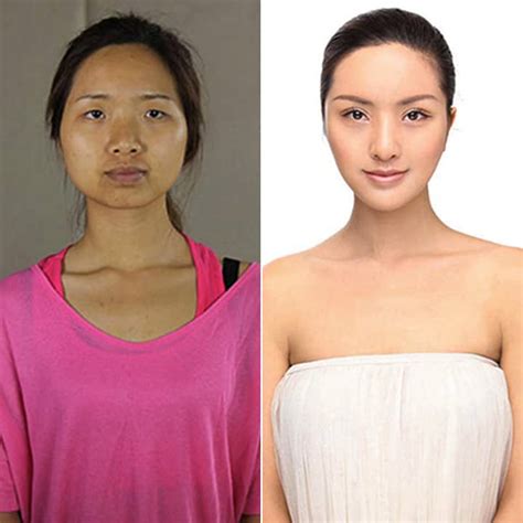 in china plastic surgery is booming