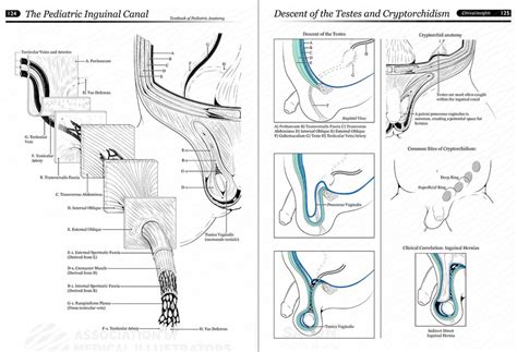 Cryptorchidism is often the cause of the disruption of the hormonal and reproductive function of. The Pediatric Inguinal Canal/Descent of the Testes and ...
