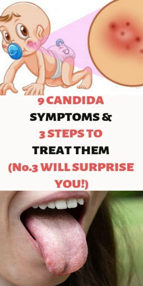 Candida Symptoms Steps To Treat Them Candida Symptoms Yeast