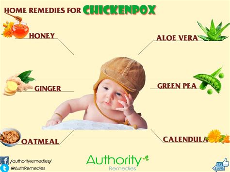 Home Remedies For Chickenpox Authority Remedies
