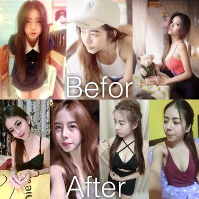 สวัสดีค่ะ คงไม่ต้องบรรยายอะไรมาก เกี่ยวกับคุณหมอบุญถิ่น หลายท่าน คงทราบกันดีอยู่แล้ว ในด้านชื่อเสียง การทำศัลยกรรมจมูกของคุณหมอ ในราคา. รูป บุญรัตน์คลินิกการแพทย์ (หมอบุญถิ่น) - Wongnai