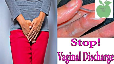 Causes Of Vaginal Discharge And Vaginal Itching Vulva Vaginal
