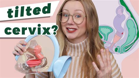 Using Menstrual Cups And Discs With A Tilted Cervix Youtube