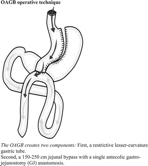 Nutritional Status Following One Anastomosis Gastric Bypass Clinical