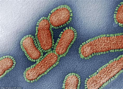 (Foto Langka) Virus Paling Mematikan : MATA DUNIA