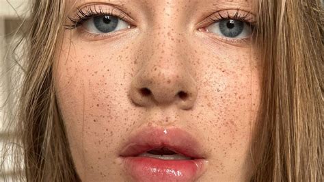 The Difference Between Sunspots And Freckles And How To Care For Each Ornella