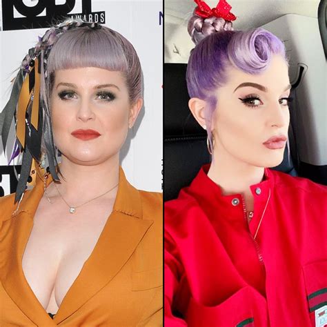 List 94 Wallpaper Kelly Osbourne Before And After Plastic Surgery Completed