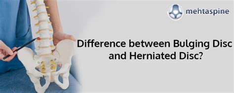 Difference Between Bulging Disc And Herniated Disc Mehta Spine