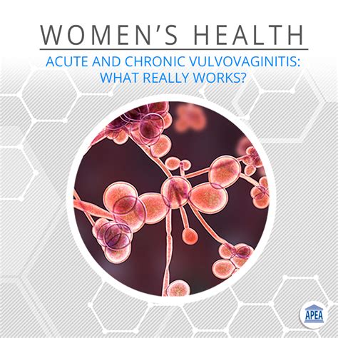 Acute And Chronic Vulvovaginitis What Really Works