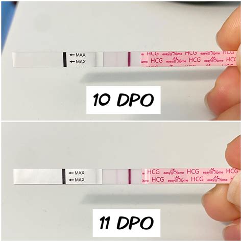 Minimal line progression 10 DPO vs 11 DPO - expected? (Easy@home HCG