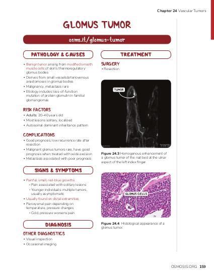 Vascular Tumors Video Anatomy Definition Function Osmosis