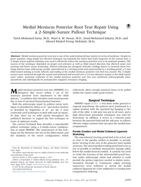 PDF Medial Meniscus Posterior Root Tear Repair Using A Simple Suture Pullout Technique