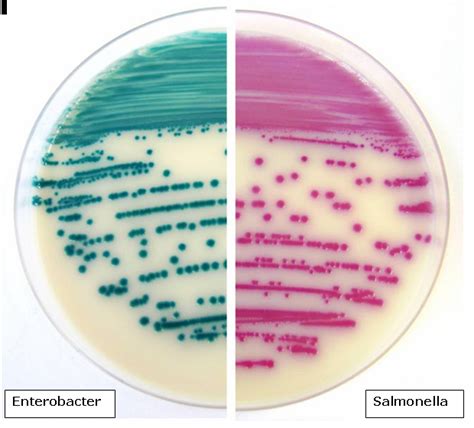 • selective and differentiating medium for the isolation of salmonellae and shigellae. NUEVOS PRODUCTOS PARA LA DETECCIÓN DE MICROORGANISMOS | Bioser