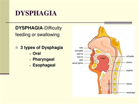 Ppt Comprehensive Dysphagia Management Powerpoint Presentation Free