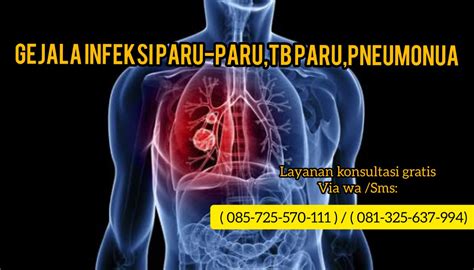 Penyebab bronkitis adalah infeksi bakteri dan kuman penyakit yang masuk melalui udara. infeksi paru-paru menular atau tidak