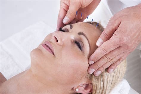 Benefits Of Acupuncture Therapy Upmc Healthbeat