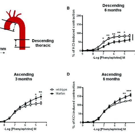 A Diagram Illustrating The Descending And Ascending Thoracic Aorta