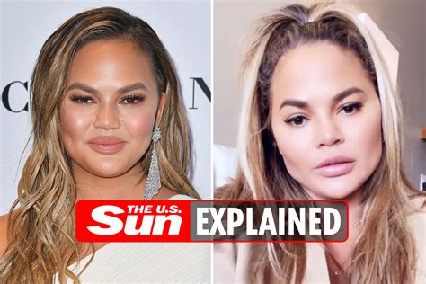 What Did Chrissy Teigen Look Like Before And After Plastic Surgery