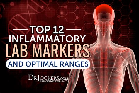 Top 12 Inflammatory Lab Markers And Optimal Ranges Systemic