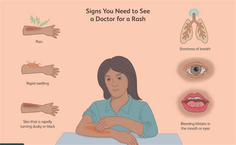 How To Tell If A Rash Needs Medical Attention Alaska
