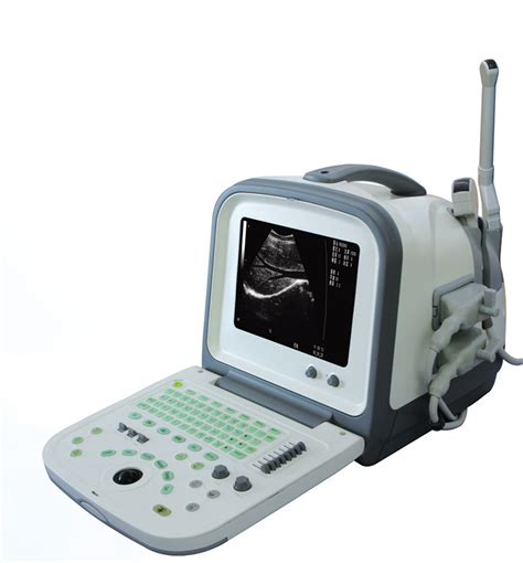 B Ultrasound Scanner Machine Model Hy5511 China B Ultrasound Scanne