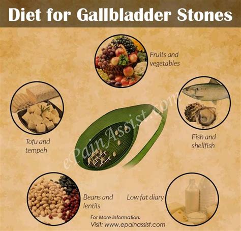 Healthy Food For Gallstones Healthy Info