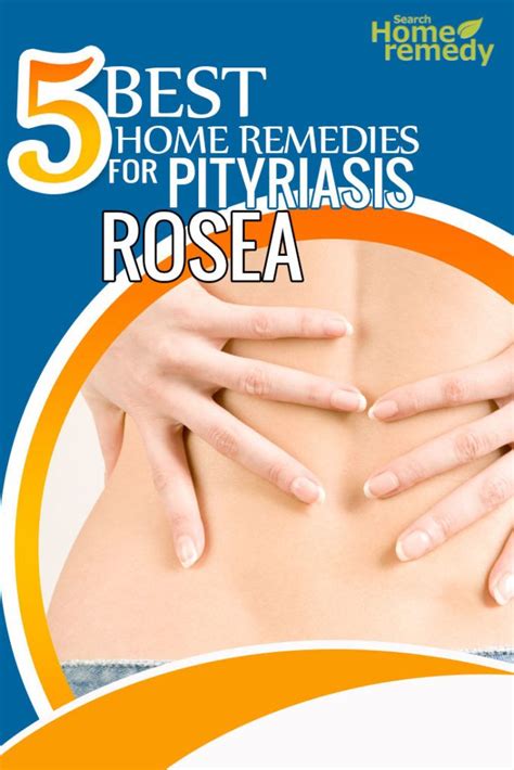 Pityriasis Rosea Treatment Adults