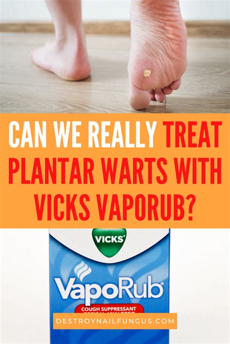Vicks Vaporub For Plantar Warts Does It Really Work