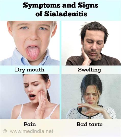 Symptoms And Signs Of Sialadenitis Salivary Gland Inflammation