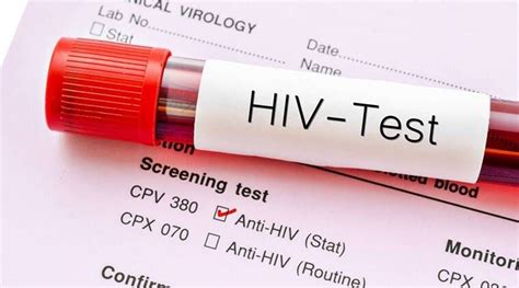 أساطير شائعة حول فيروس نقص المناعة البشرية حان وقت دحضها جريدة الغد