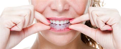 Do it yourself braces safety concerns. Beware of Do-it-Yourself Orthodontics