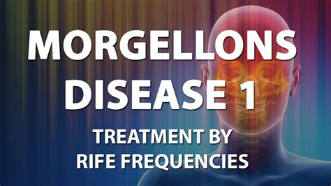 Morgellons Disease 1 Rife Frequencies Treatment Energy And Quantum Medicine With Bioresonance