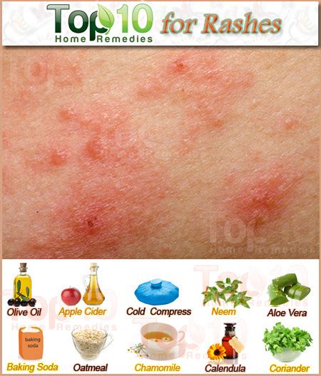 Face Allergy Treatment At Home Doctor Heck