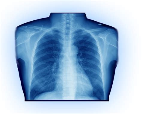 X Ray Png