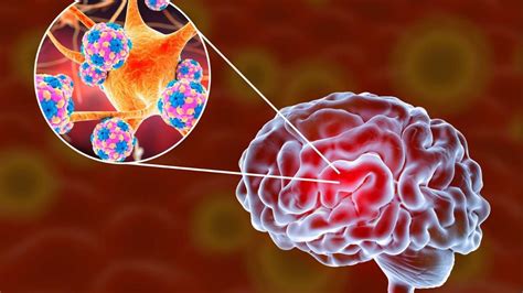 Meningite O que é causas sintomas e tratamentos BoaConsulta