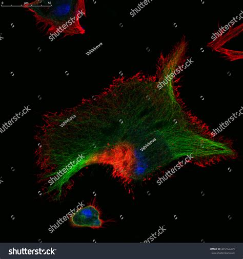 Real Fluorescence Microscopic View Human Skin Stock Photo 465562469