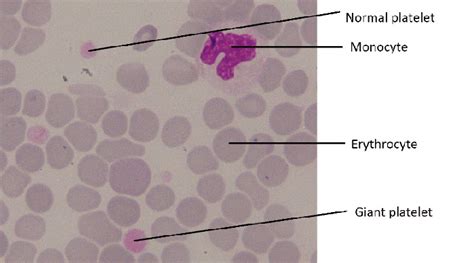 Digitalization Microscopic Peripheral Blood Smear Download Scientific