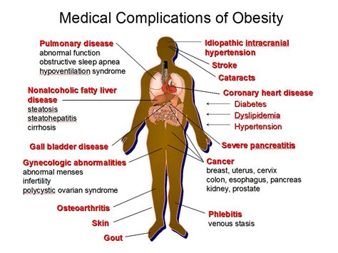 Obesity Related Conditions Laser Stone Surgery Endoscopy Centre