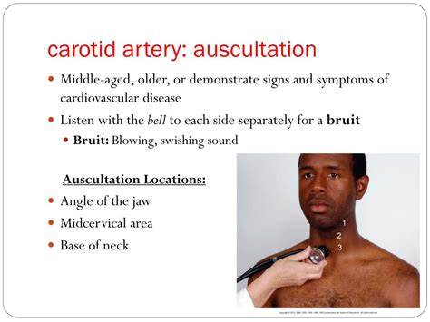 Carotid Artery Auscultation