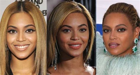 Beyonce Nose Job Before And After 2023