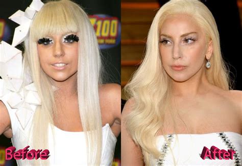 Леди Гага до и после пластики красота в камне или искусство трансформации Личная жизнь
