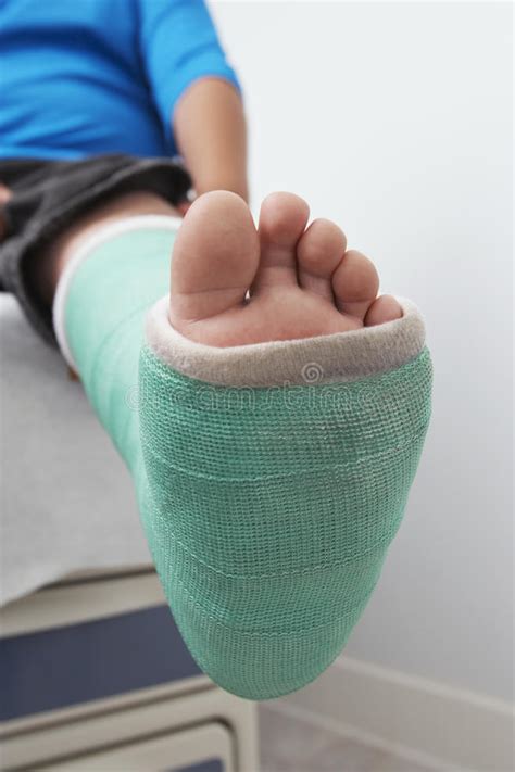 Boy S Leg In Plaster Cast Stock Photo Image Of Foot 29663924