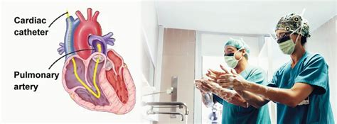 Cardiac Catheterisation Right Heart Catheter Pha
