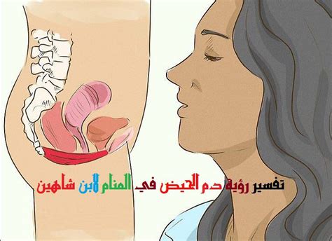 لنتعرف في هذا المقال على أعراض التهاب عنق الرحم، أسبابه، وطرق علاجه. تفسير الحيض في المنام , تفسير رؤيه الحيض - الغدر والخيانة