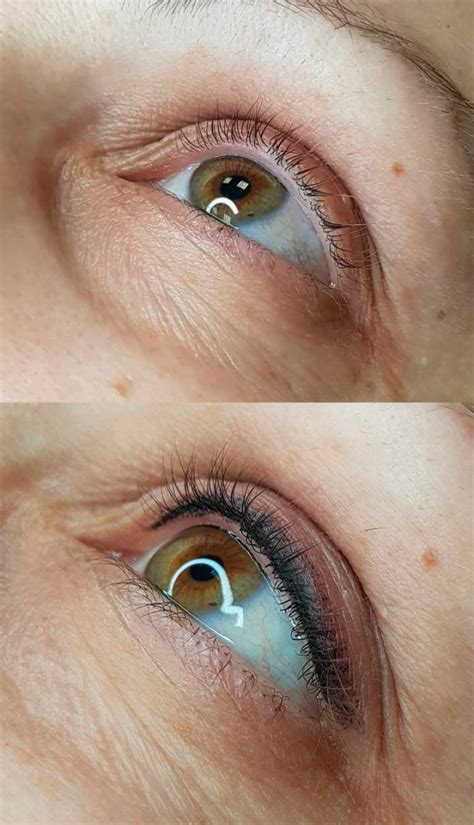 Conjunctivitis And Eyeliner Tattoo What You Need To Know