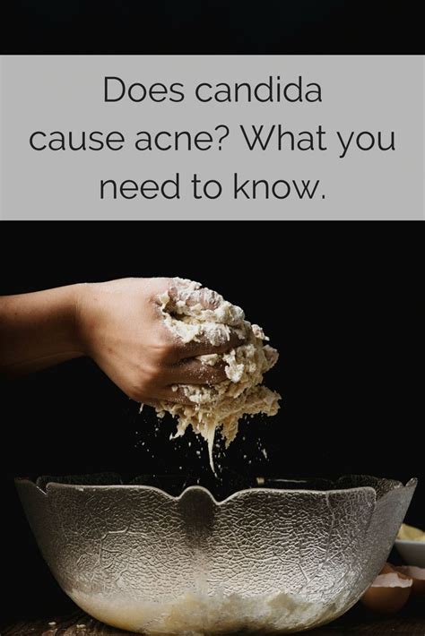 Does Candida Cause Acne What You Need To Know Acneclearing