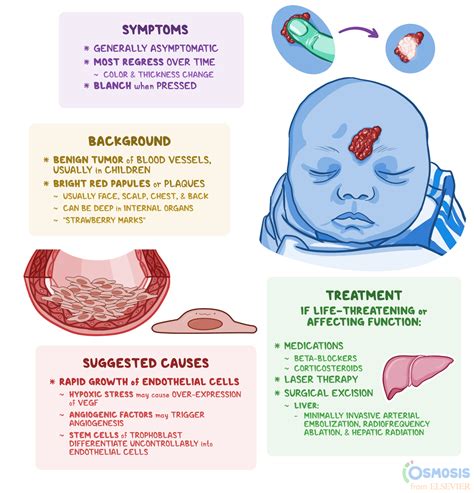 What Are Hemangiomas