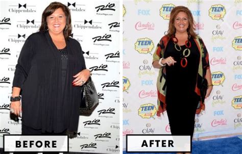 Top 21 Celebrity Bariatric Surgery Transformations