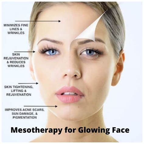 mesotherapy for face prp treatment center