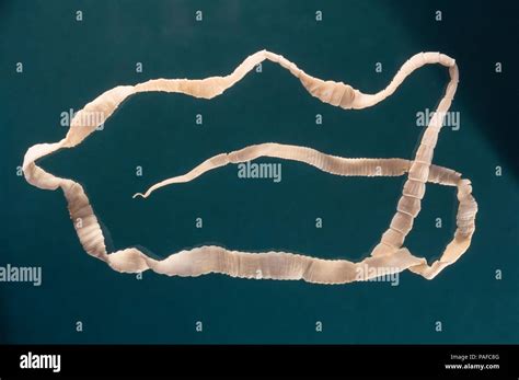 Tapeworm In Human Body